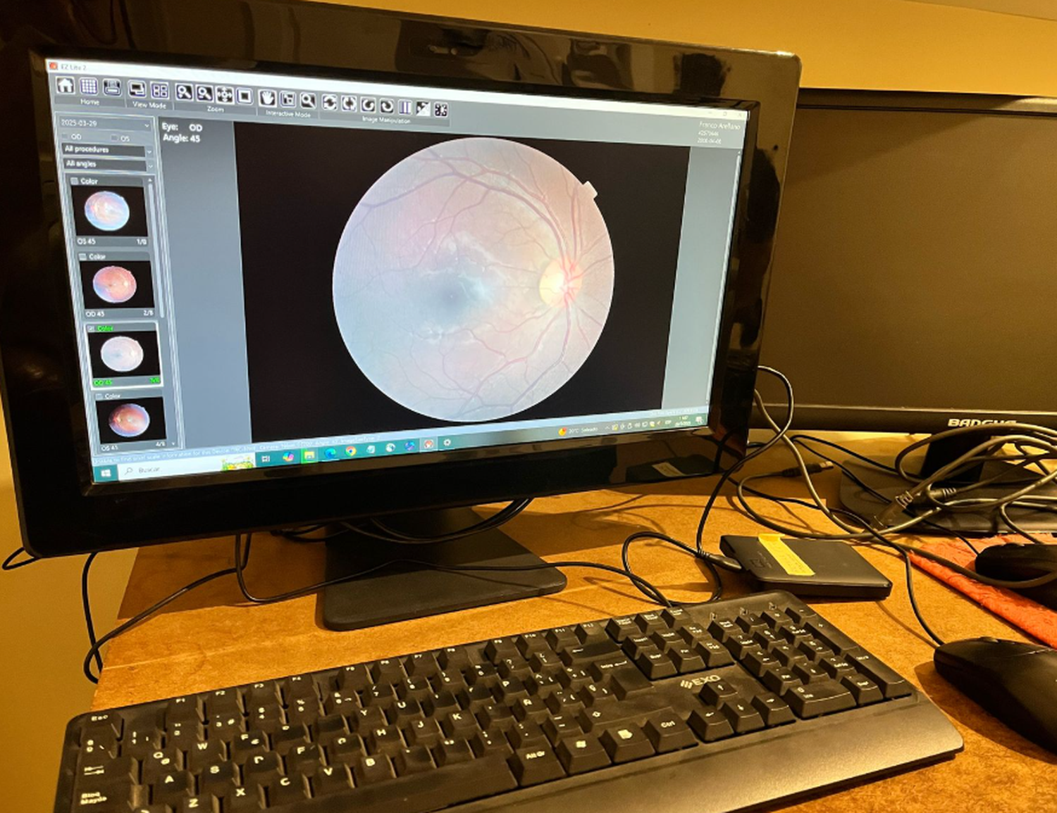 retinar - 2
