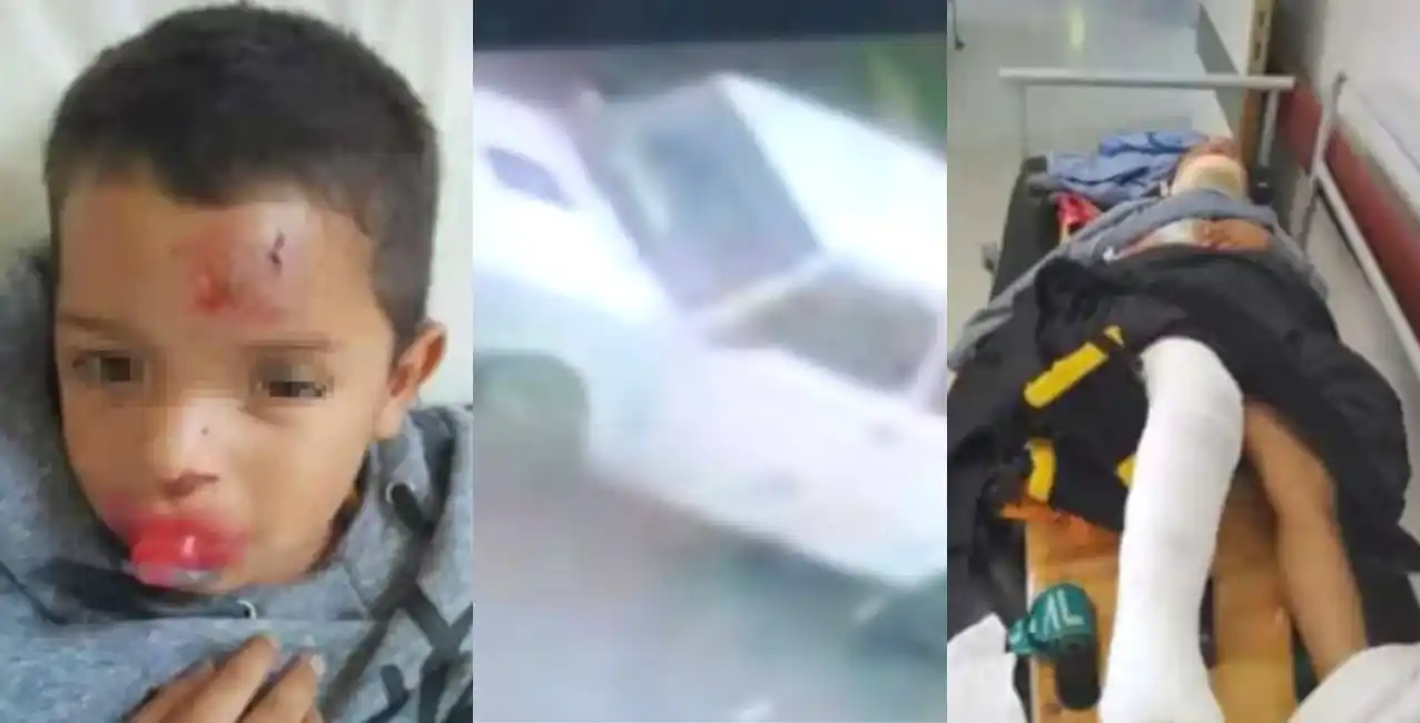 La Plata: un niño de cuatro años fue atropellado y el conducto se dio a la fuga