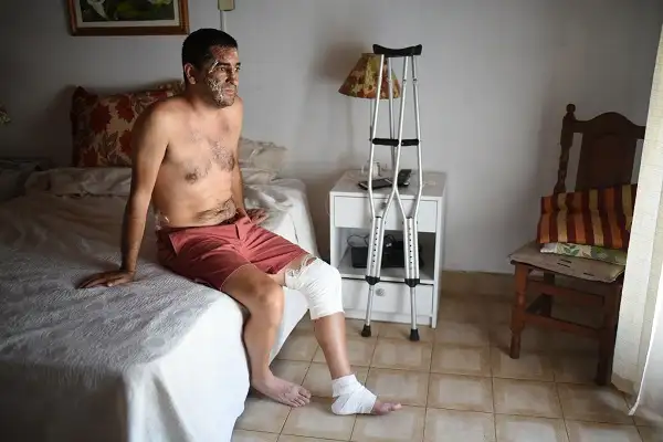 Iba en bicicleta por la ruta, lo chocaron y lo dieron por muerto