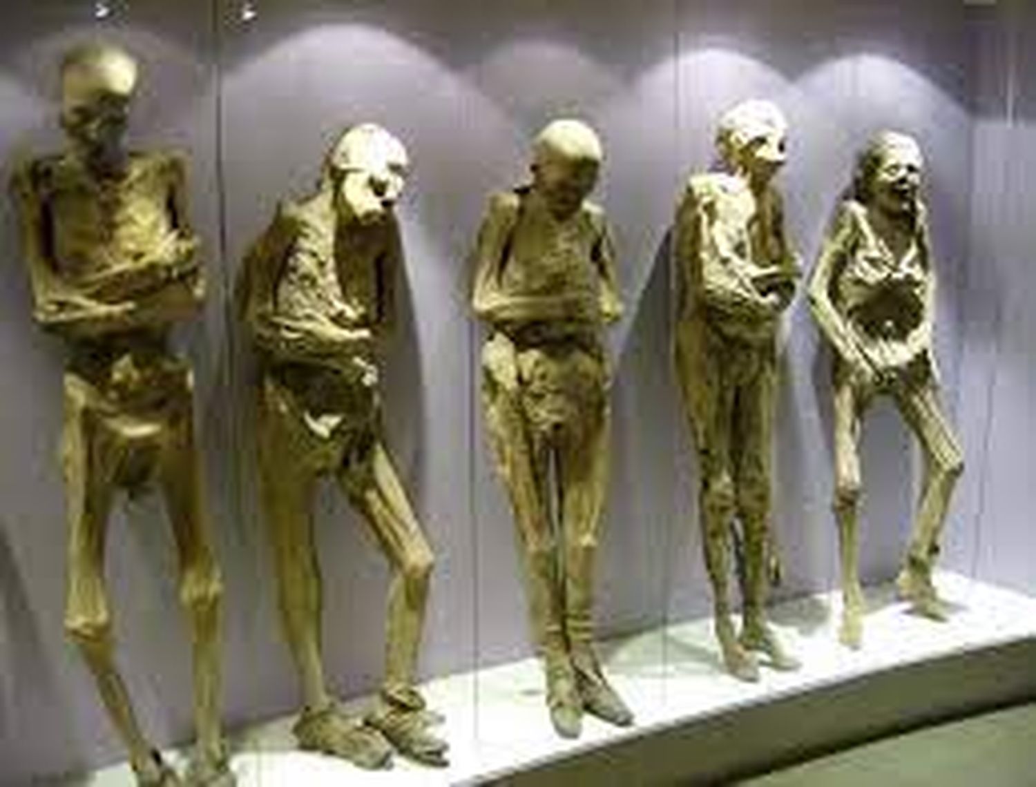 Perturbador lo que pasa dentro del museo de cuerpos humanos en Bogotá