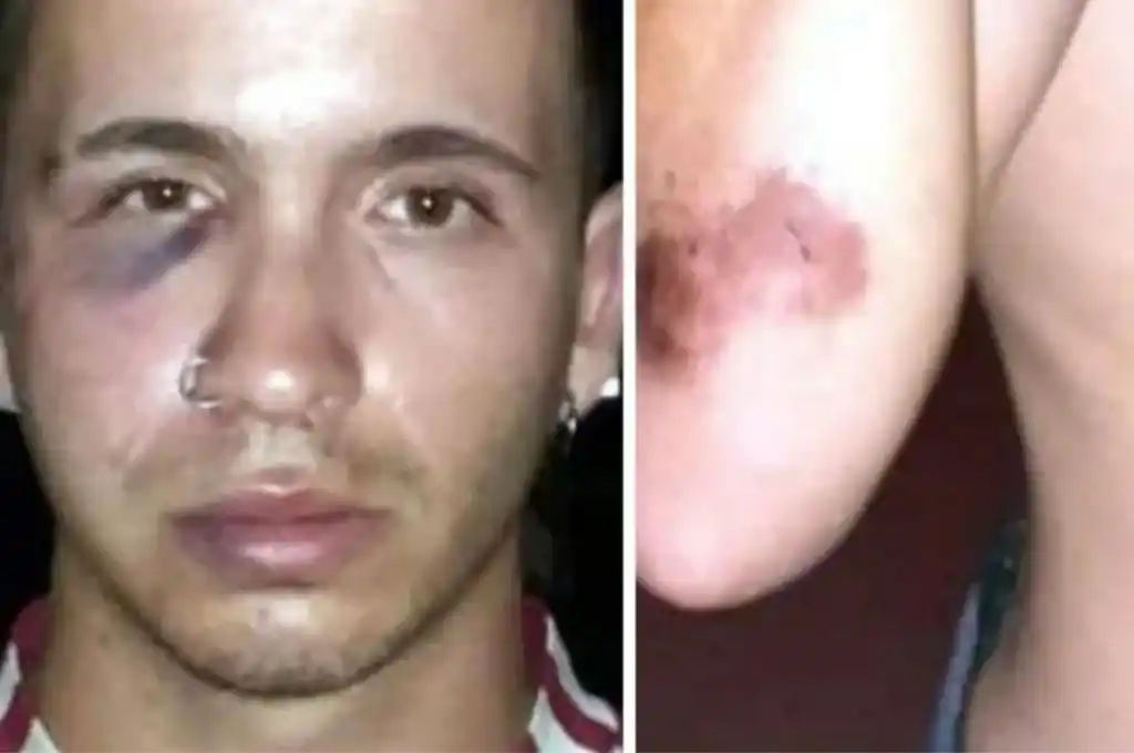 Policías golpearon salvajemente a un joven tras confundirlo con un delincuente