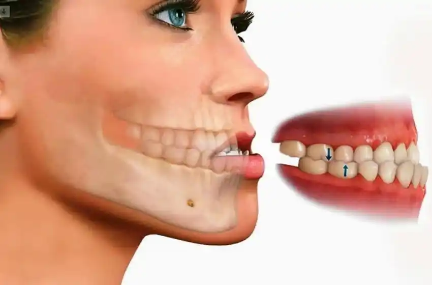 Sufre de prognatismo y necesita que su obra social autorice la ortopedia para operarse