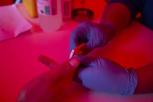 ES EL SÉPTIMO CASO: curan a paciente de VIH con trasplante de médula ósea