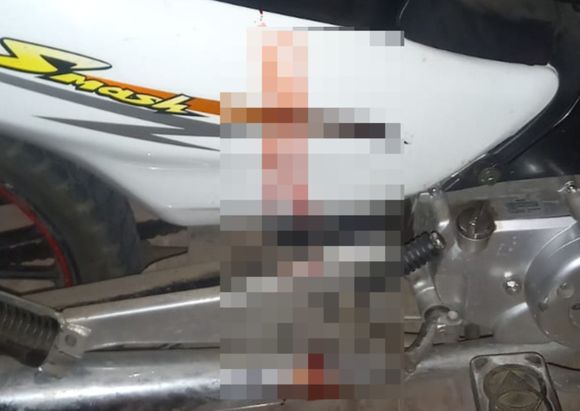 Mujer de 67 años fue víctima del ataque de un perro en Novillo y Salta: “Ese lugar tiene un montón de antecedentes”