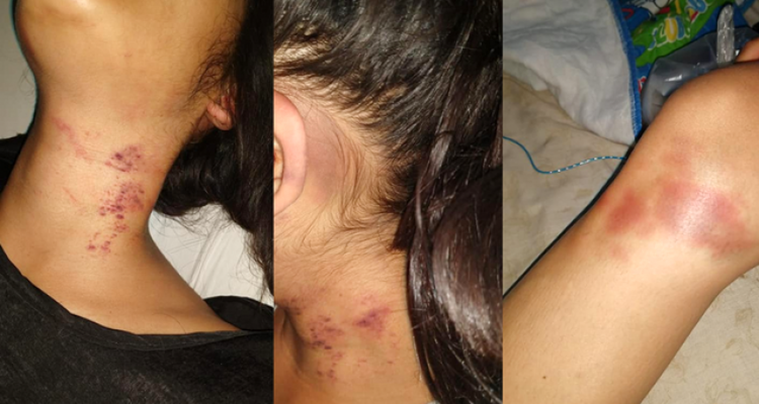Cambio de carátula para un caso de violencia de género: de “intento de femicidio”,  a “lesiones leves”