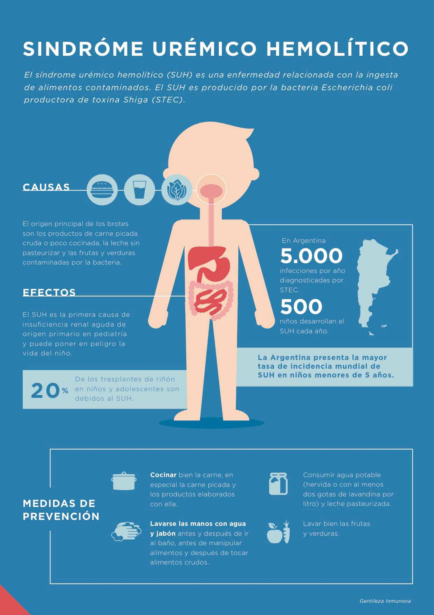 La prevención del Síndrome Urémico Hemolítico