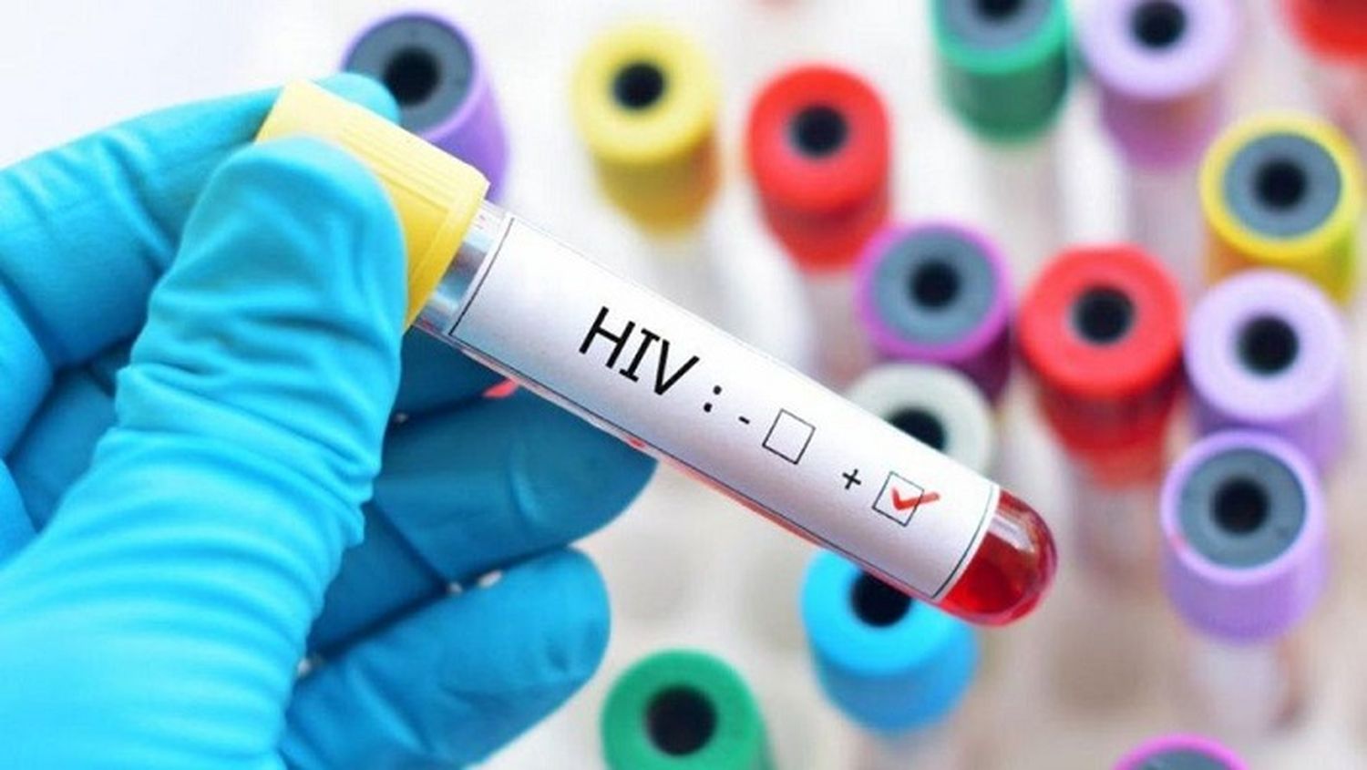 Un estudio francés descubrió una fórmula que permite eliminar el virus del VIH