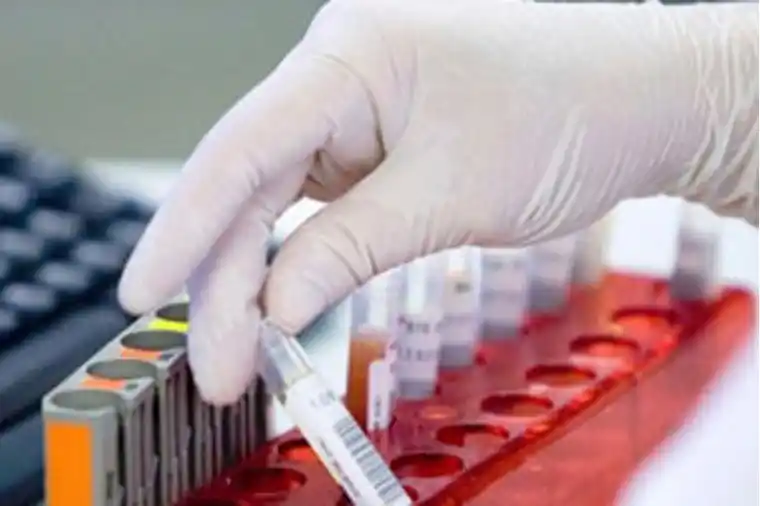 Publicación Solicitada: Laboratorios de Análisis en crisis