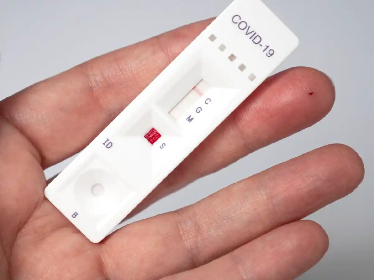 San Francisco, a la espera de la llegada de los primeros autotest para coronavirus