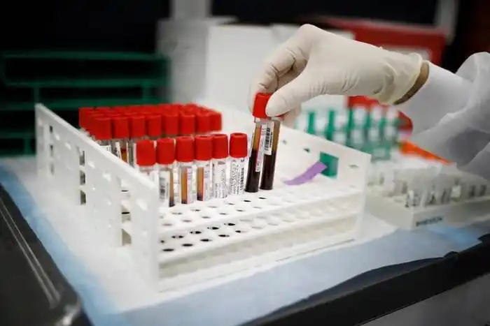 COVID-19: los niveles de  antígenos están vinculados al desarrollo de enfermedad grave