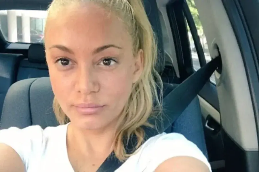 ¡Irreconocible! El impactante cambio estético de María Eugenia Ritó tras someterse a un tratamiento facial