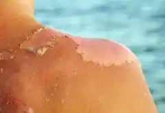 ¿Por qué nos despelechamos en el verano?