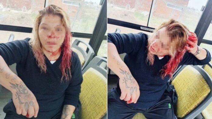 Bahía Blanca: la emboscaron en un micro y le pegaron salvajemente con un caño