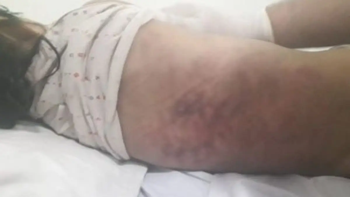 LE DESPRENDIÓ EL CORAZÓN: hombre mató a golpes a su hijastra de 1 año y 4 meses por defecar sobre él