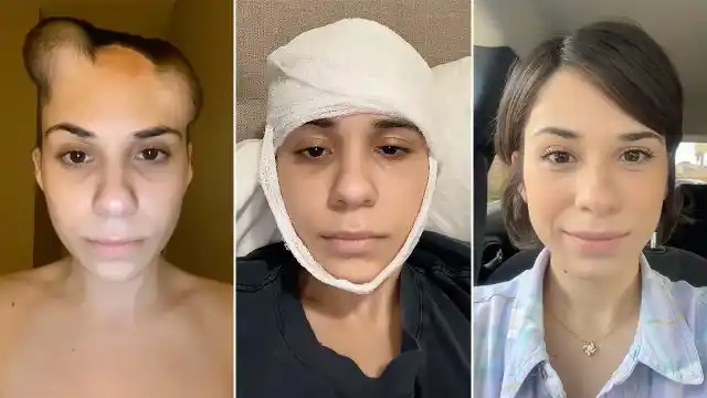 La joven mexicana Alondra Sierra comparte su experiencia de sobrevivir al Melanoma