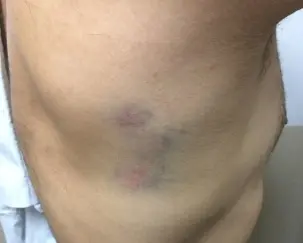 Denuncian feroz ataque contra un notificador judicial en Quilmes