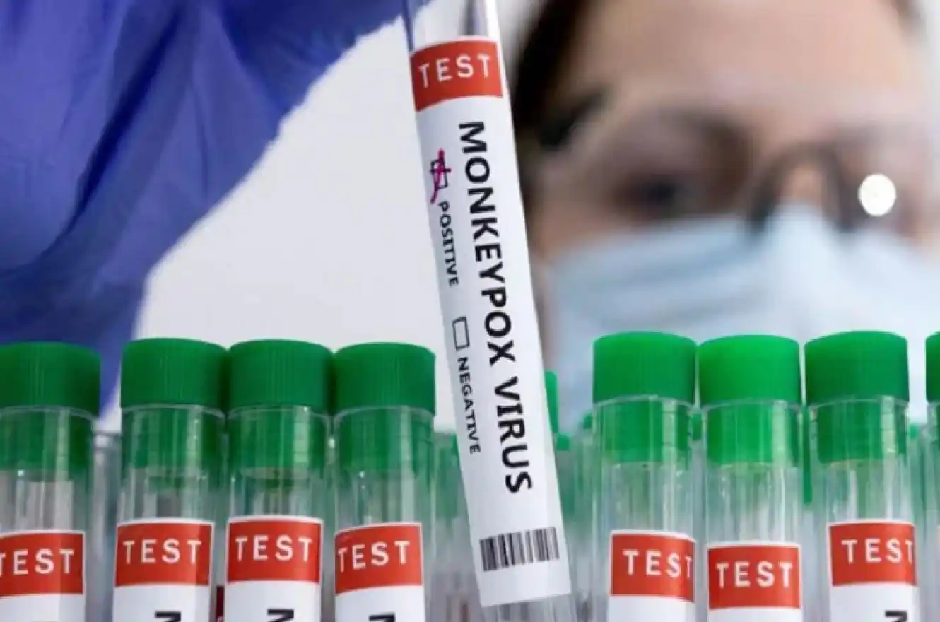 Ya se confirmaron casi 650 casos de viruela del mono en el mundo