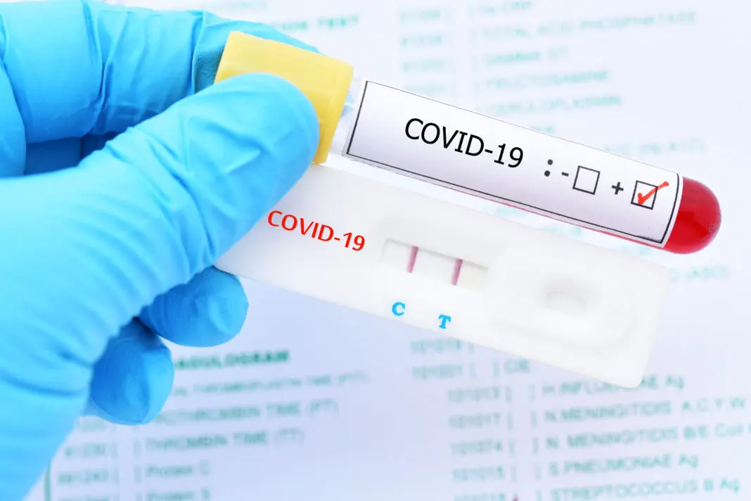 Volvió a crecer el número de contagios y de casos positivos