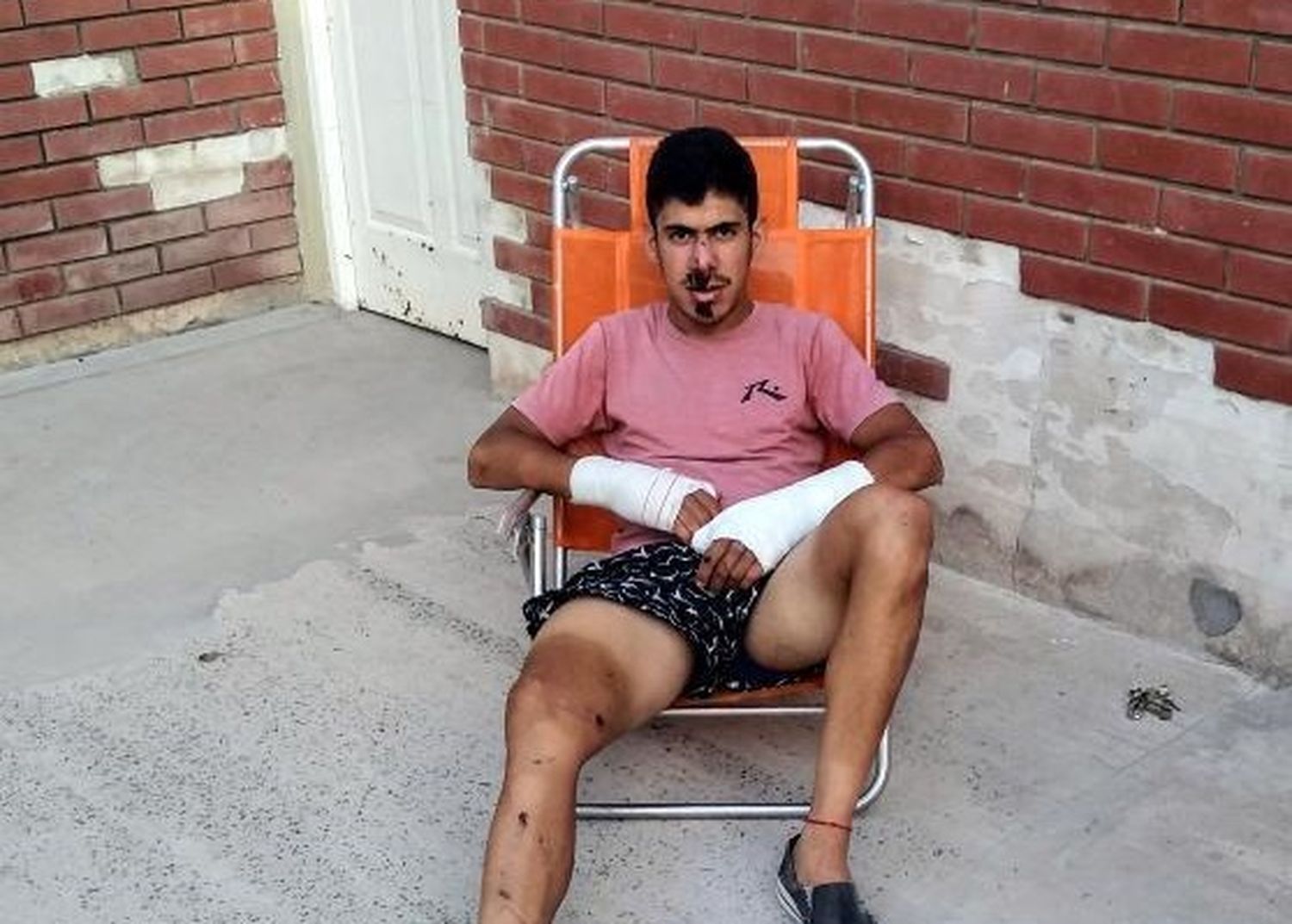Agustín Basualdo: “Mi familia se pensó lo peor y eso me afectó más que el accidente”