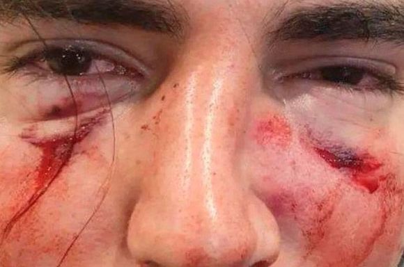 Un grupo de rugbiers atacan con una brutal golpiza a un chico de 18 años