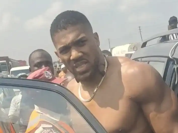 Antonhy Joshua fue dado de alta tras un accidente automovilístico.