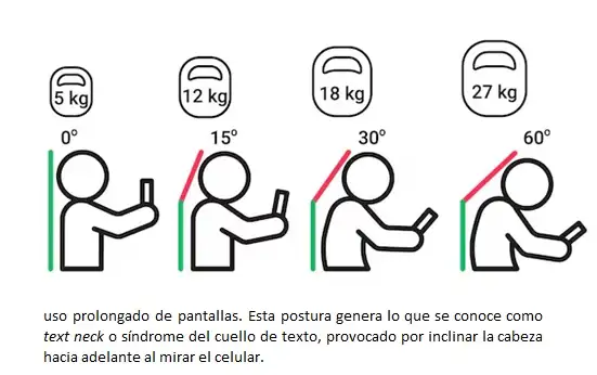 Síndrome de cuello de texto
