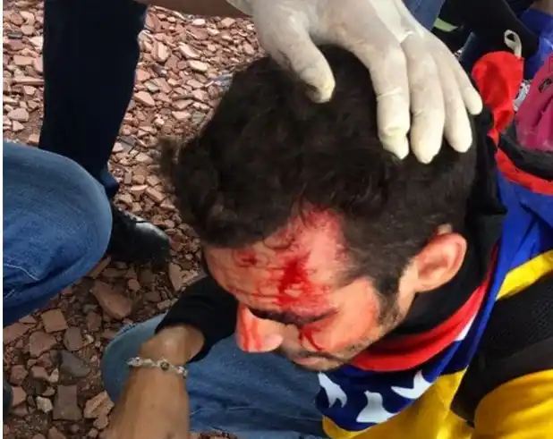 La policía chavista disparó con gases lacrimógenos