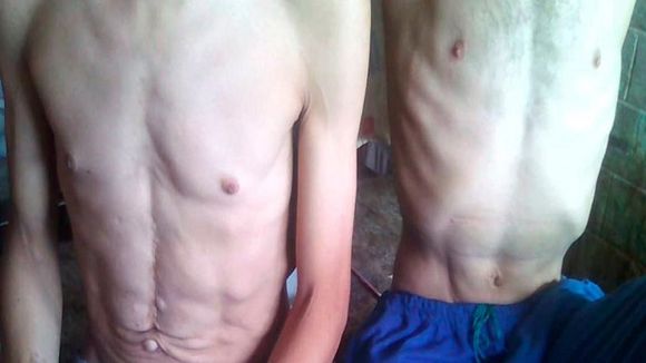 LOS MATAN DE HAMBRE: presos en Venezuela están a merced de un Estado que los priva de alimentos