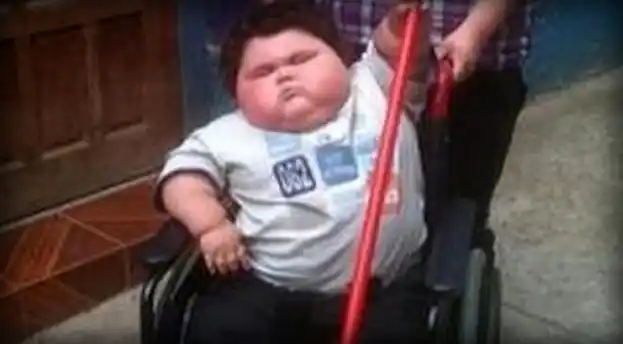 Internan a un nene de cinco años que pesa 116 kilos