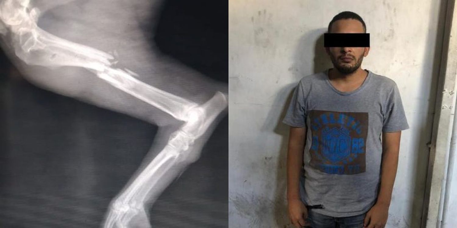 Meten preso en Chacao a hombre que le pegó a un perro con un amortiguador