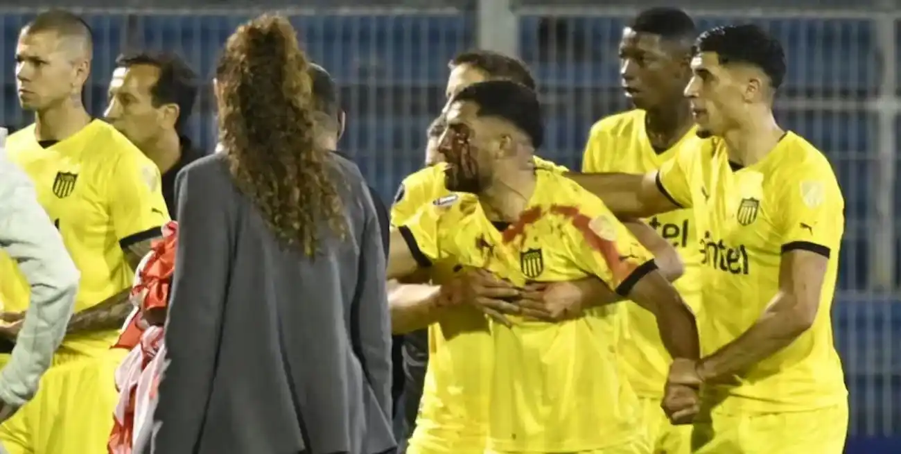 El futbolista quedó sangrando y enloqueció contra los hinchas locales.