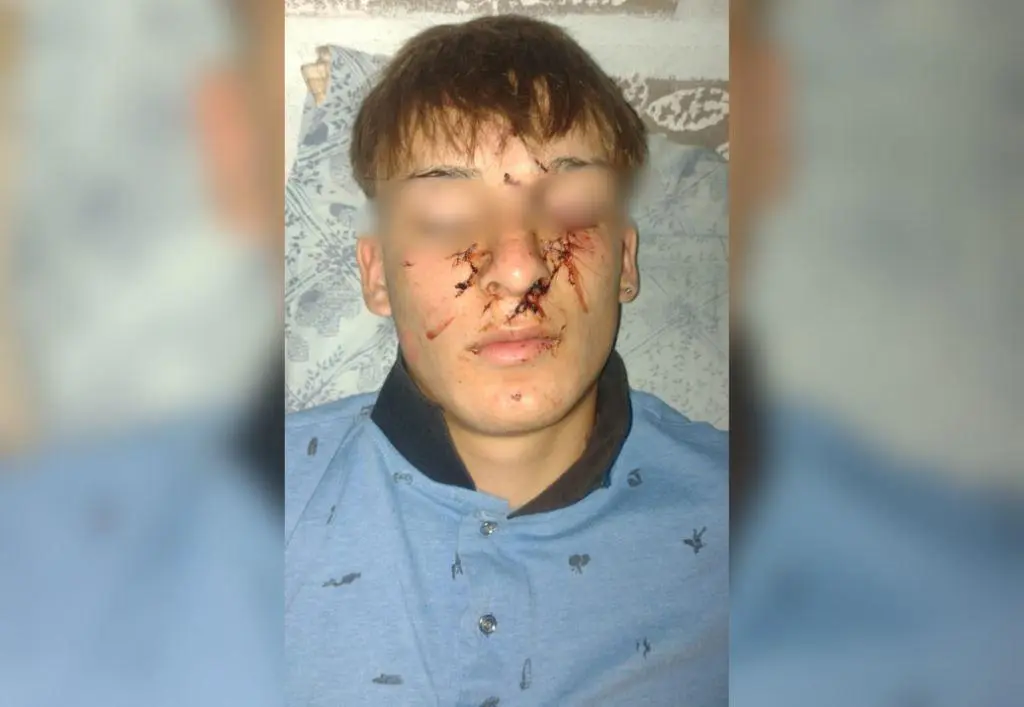 Violencia en la noche del viernes: menor golpeado en un pub de Claromecó