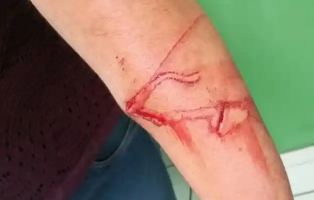 Nene de 10 años acuchilló a su maestra por un desafío viral