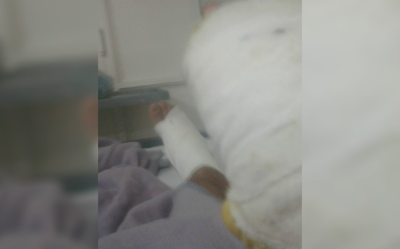 El hombre que prendió fuego el patio de su sobrino permanece internado con quemaduras