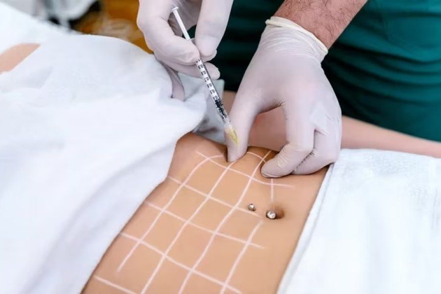 Crece la cantidad de uruguayos que viaja a Argentina a hacerse cirugías estéticas