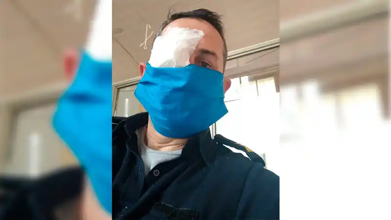 "Nos pudieron haber matado", advirtió uno de los policías ferozmente agredido