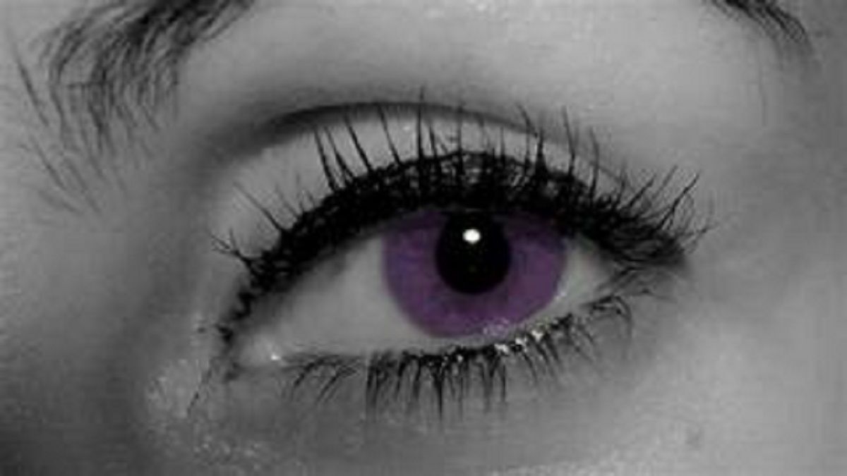 OJOS VIOLETA o «síndrome de Alejandría»: lo que se sabe de esta rara condición