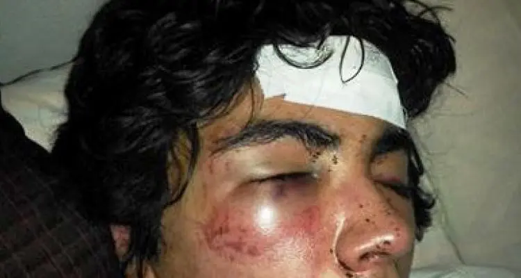 Piden colaboración para dar con el agresor del joven que fue brutalmente golpeado