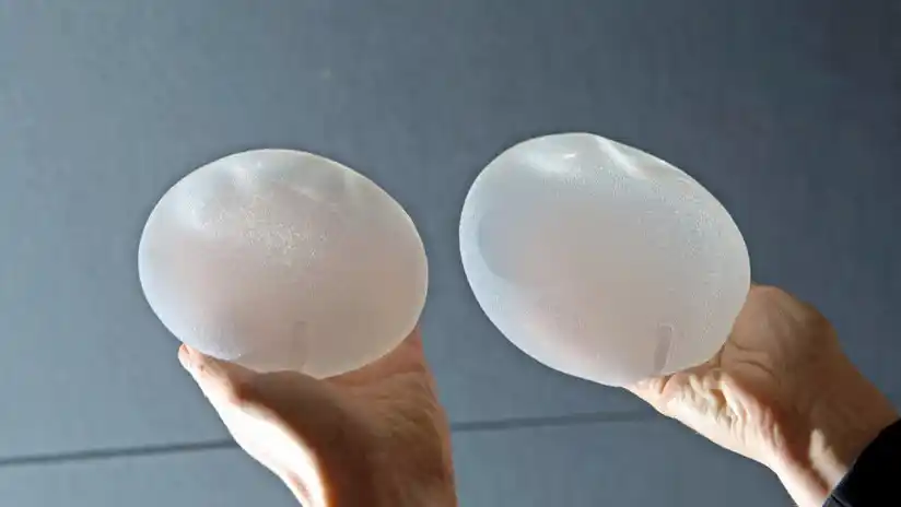 Retiran del mercado argentino unos implantes mamarios sospechados de causar cáncer