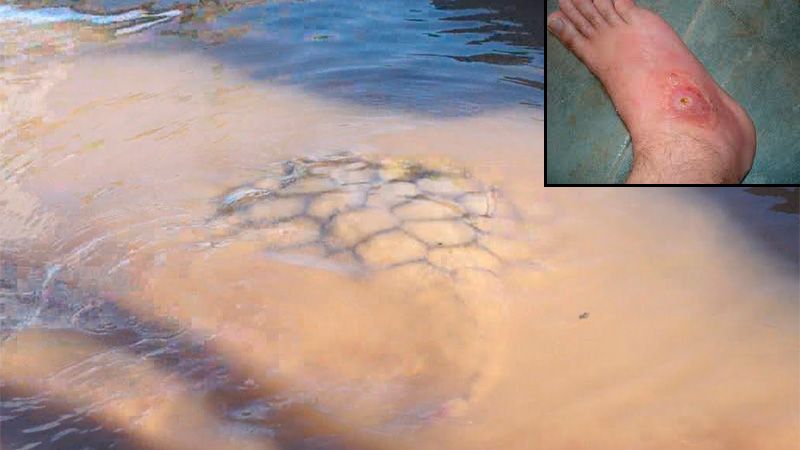 Un bañista fue atacado por una raya en el río y debió ser hospitalizado