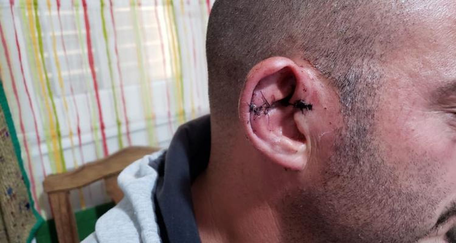 Conflicto vecinal en El Amanecer: una golpiza, un herido de arma de fuego y amenazas constantes