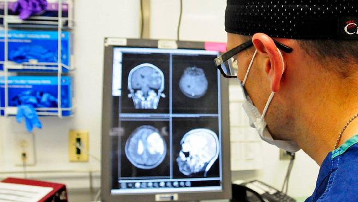 Científicos advierten de potencial ola de lesiones cerebrales relacionadas al COVID-19
