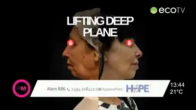 El doctor Martín Fernández y el lifting deep plane