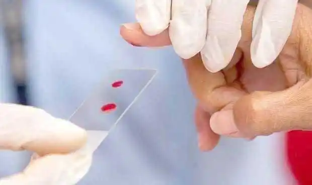 En el Hospital Distrital 8 se llevó a cabo la
primera cirugía laparoscópica de hernia