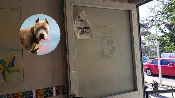 Se recupera un bebé que fue mordido en la cara por un pitbull