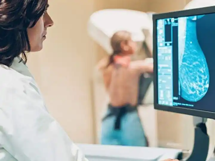 Cáncer de mama: un test genómico permite determinar el mejor tratamiento para cada caso