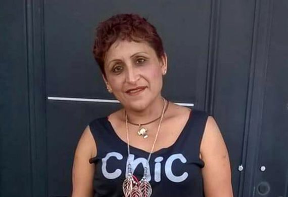 Un perro mordió a una nena en el barrio General Belgrano y le provocó graves heridas