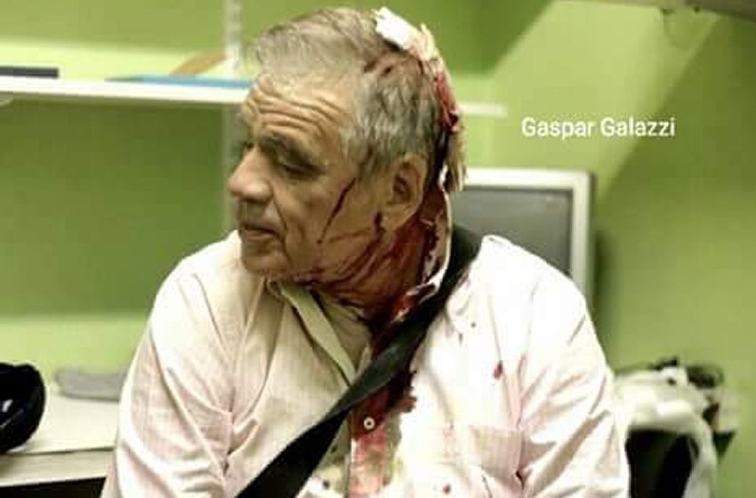 Julio Bazán: “Me suturaron con cinco ganchos la cabeza por el golpe”