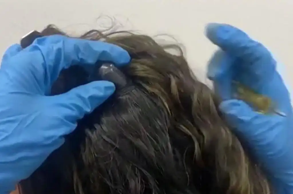 Dos detenidas por querer ingresar droga a España en “narcopelucas”