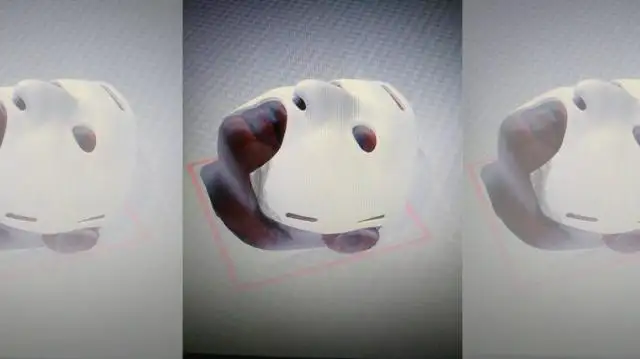 Cirujanos argentinos crearon máscara 3D para reconstrucción facial en casos de quemaduras